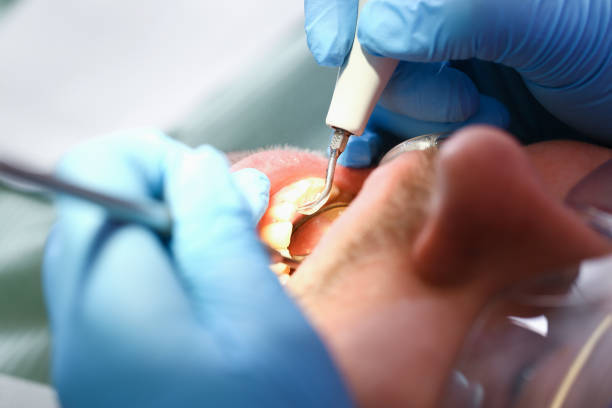 Best Urgent Tooth Repair  in Mount Repose, OH