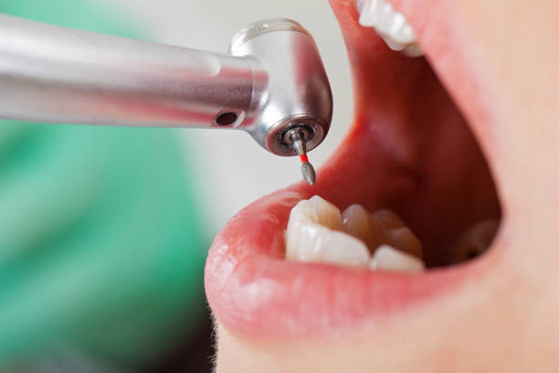 Best Urgent Tooth Repair  in Mount Repose, OH
